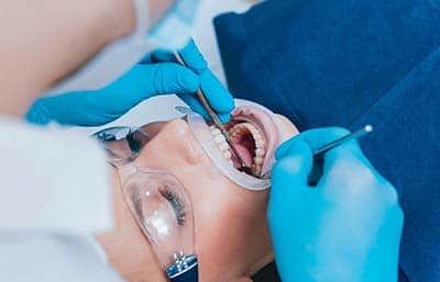 dental crowding woman