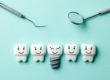 a group of animated dental implants smile