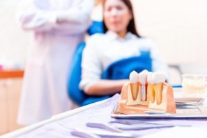 Best dental implants in Texas.