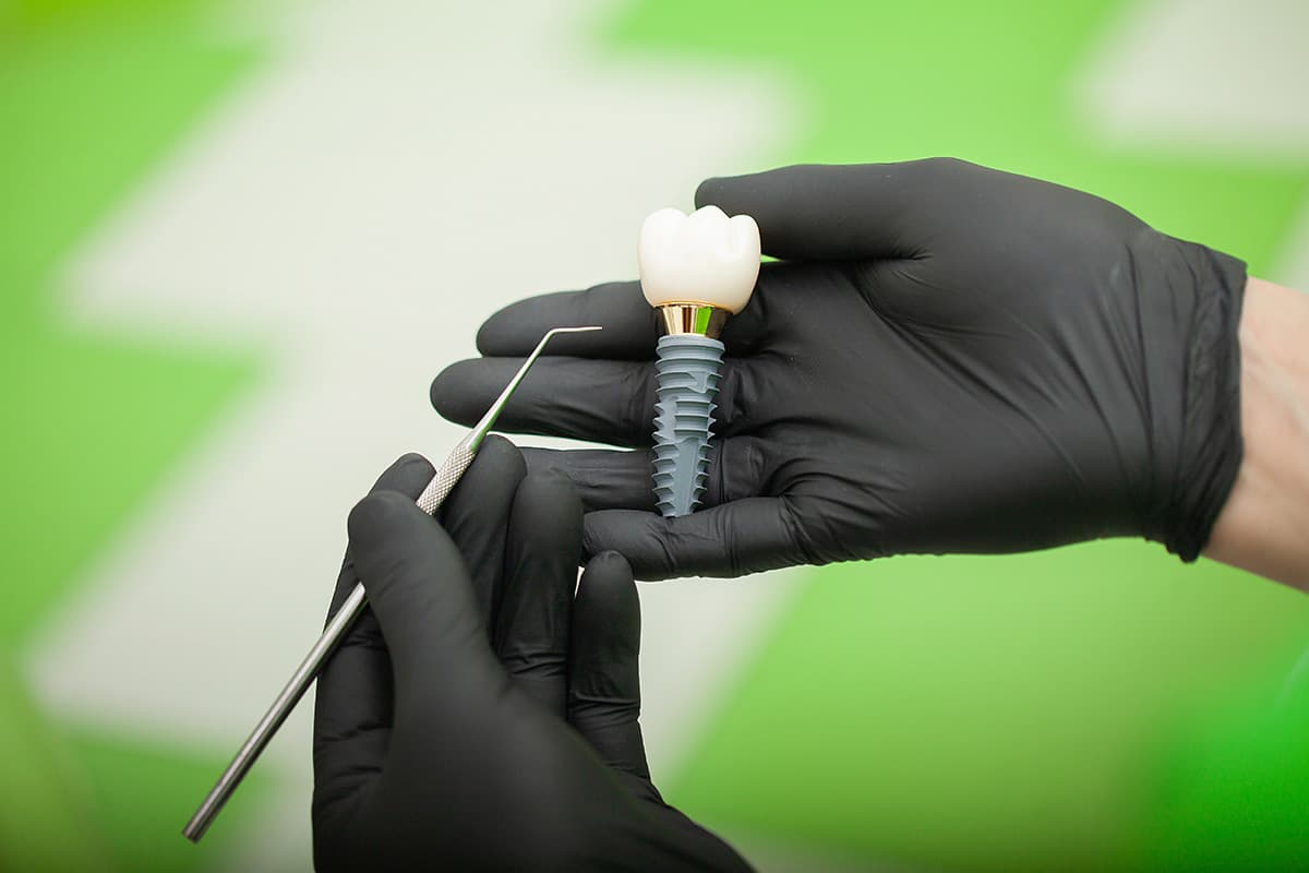 dental implants dentist making dental implants
