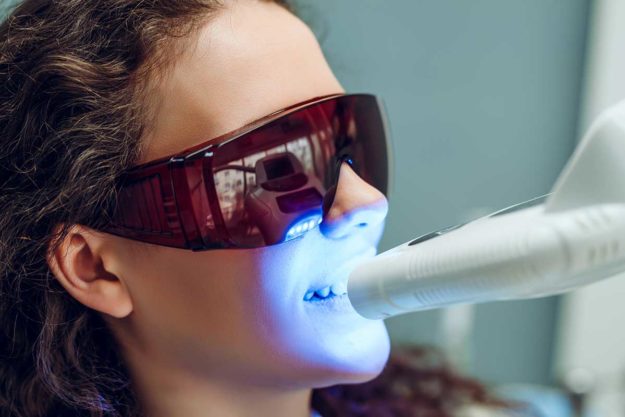 whitening-teeth Young woman gets her teeth whitened